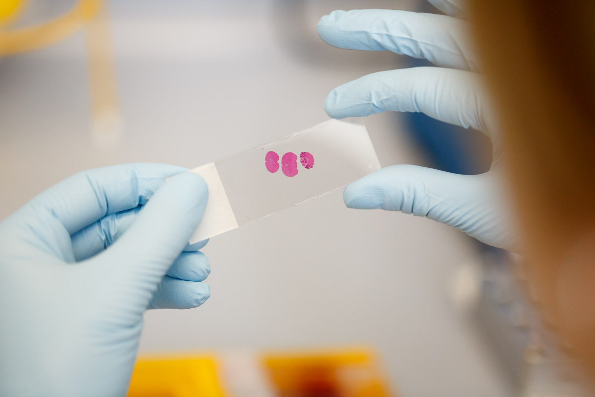 dkfz kitz pm 2019 09